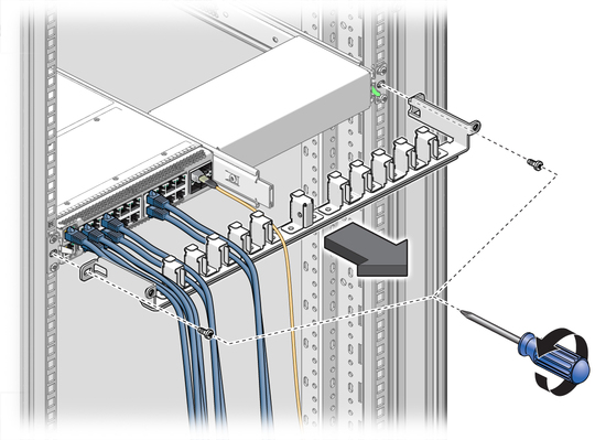 image:Figure shows removing the CMA.